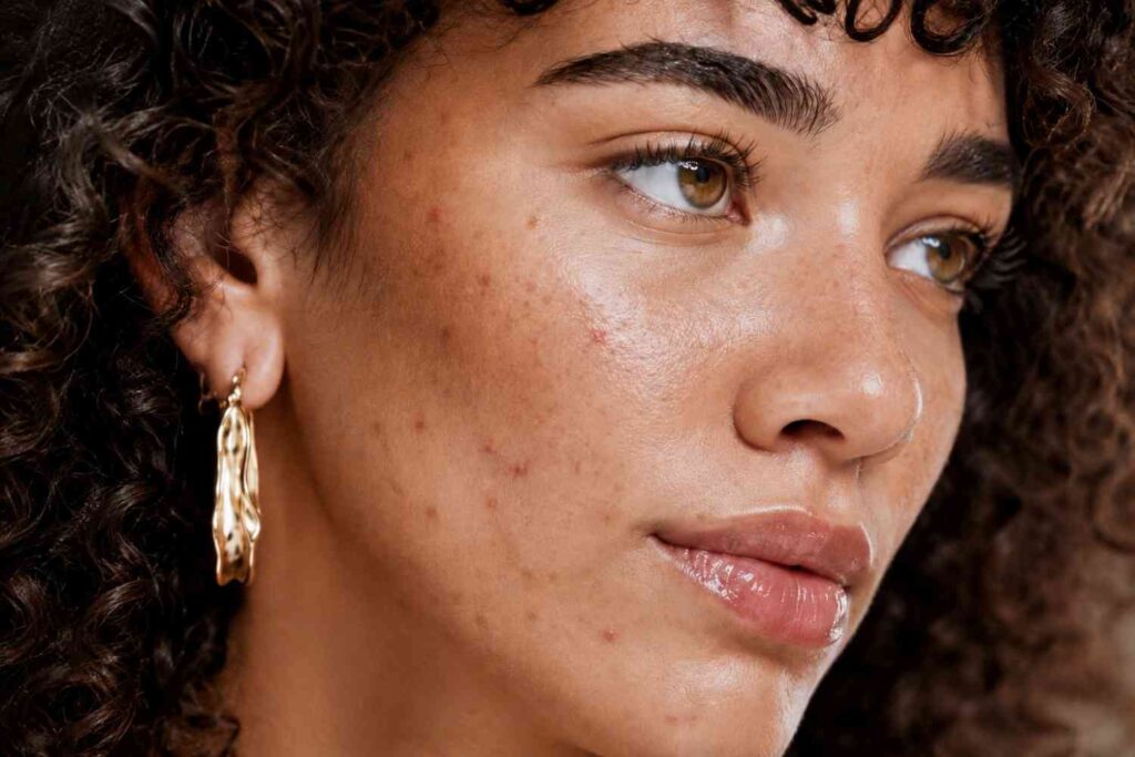 High-End Retouching After Comparison Clippingbeast